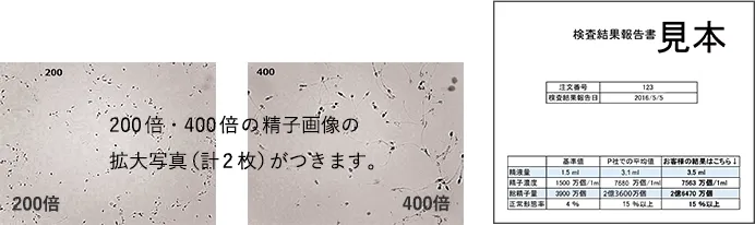 検査/納品項目:精液量あり、精子濃度あり、総精子数あり、精子正常形態率あり、精子画像あり