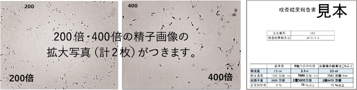 200倍・400倍の精子画像の拡大写真(計2枚)がつきます。検査項目:精液量・精子濃度・総精子数・精子正常形態率・精子画像