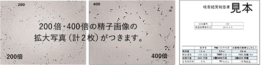 200倍・400倍の静止画像の拡大写真(系2枚)がつきます。