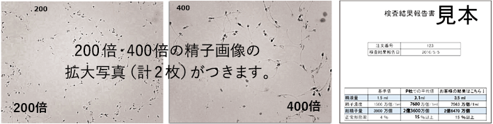 200倍・400倍の精子画像の拡大写真(計2枚)がつきます。検査項目:精液量・精子濃度・総精子数・精子正常形態率・精子画像